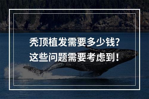 秃顶植发需要多少钱？这些问题需要考虑到！