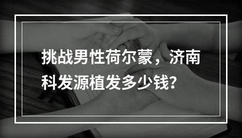 挑战男性荷尔蒙，济南科发源植发多少钱？