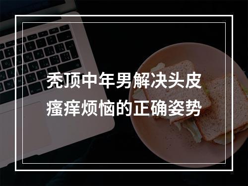 秃顶中年男解决头皮瘙痒烦恼的正确姿势