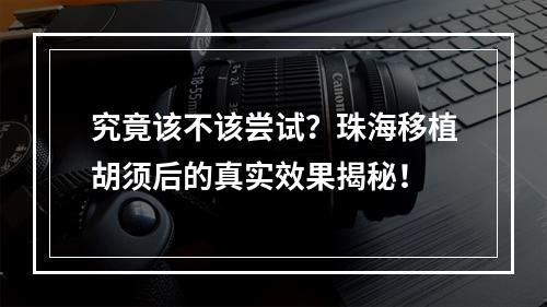 究竟该不该尝试？珠海移植胡须后的真实效果揭秘！