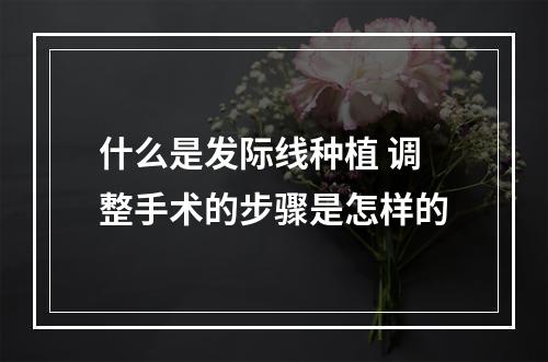 什么是发际线种植 调整手术的步骤是怎样的