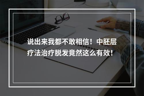 说出来我都不敢相信！中胚层疗法治疗脱发竟然这么有效！