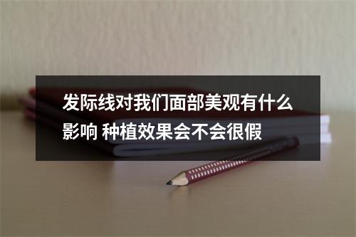 发际线对我们面部美观有什么影响 种植效果会不会很假