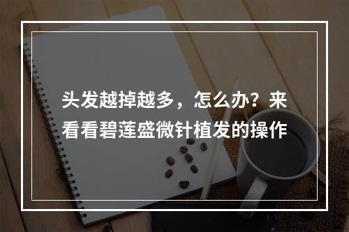 头发越掉越多，怎么办？来看看碧莲盛微针植发的操作