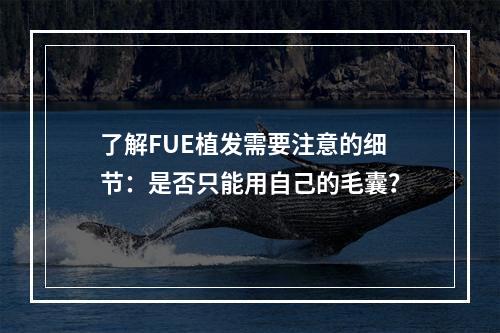 了解FUE植发需要注意的细节：是否只能用自己的毛囊？