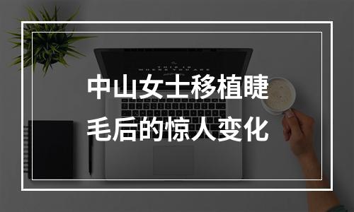 中山女士移植睫毛后的惊人变化