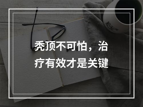 秃顶不可怕，治疗有效才是关键