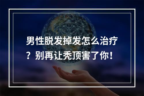 男性脱发掉发怎么治疗？别再让秃顶害了你！