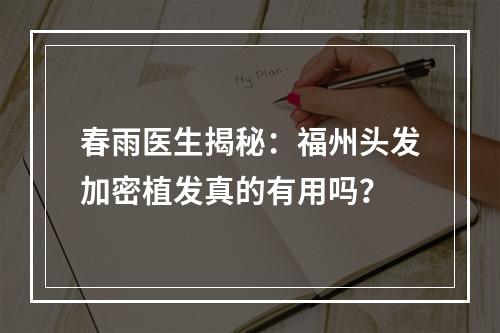 春雨医生揭秘：福州头发加密植发真的有用吗？