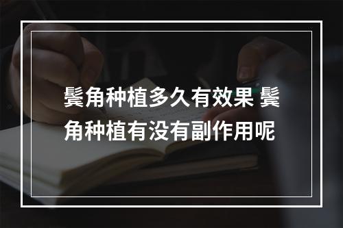 鬓角种植多久有效果 鬓角种植有没有副作用呢