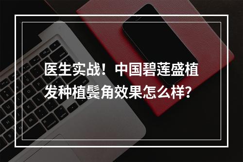 医生实战！中国碧莲盛植发种植鬓角效果怎么样？