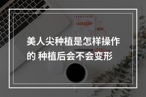 美人尖种植是怎样操作的 种植后会不会变形