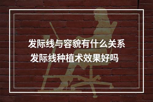 发际线与容貌有什么关系 发际线种植术效果好吗