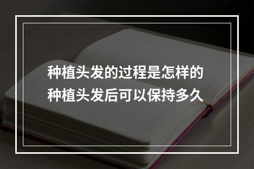 种植头发的过程是怎样的 种植头发后可以保持多久