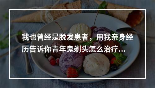 我也曾经是脱发患者，用我亲身经历告诉你青年鬼剃头怎么治疗最有效