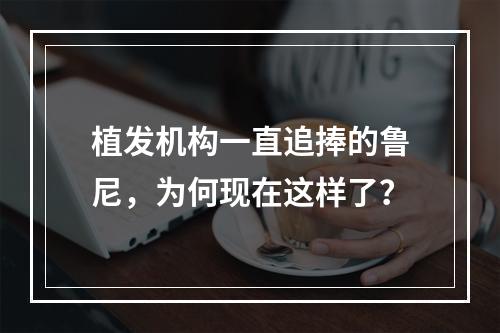 植发机构一直追捧的鲁尼，为何现在这样了？