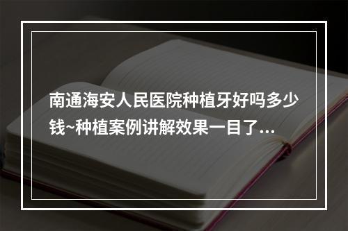 南通海安人民医院种植牙好吗多少钱~种植案例讲解效果一目了然~