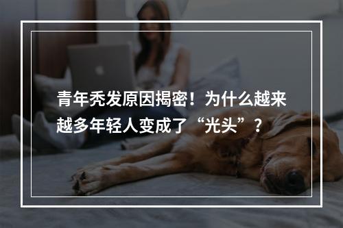 青年秃发原因揭密！为什么越来越多年轻人变成了“光头”？