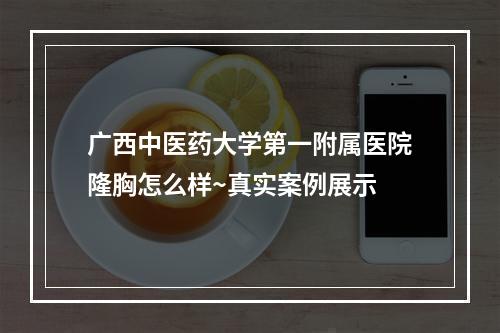 广西中医药大学第一附属医院隆胸怎么样~真实案例展示