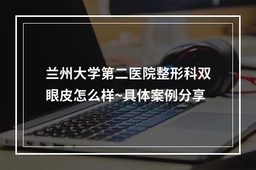 兰州大学第二医院整形科双眼皮怎么样~具体案例分享