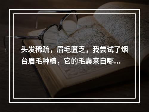 头发稀疏，眉毛匮乏，我尝试了烟台眉毛种植，它的毛囊来自哪里？