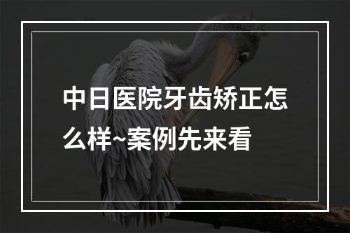 中日医院牙齿矫正怎么样~案例先来看