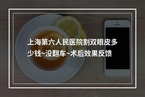 上海第六人民医院割双眼皮多少钱~没翻车~术后效果反馈