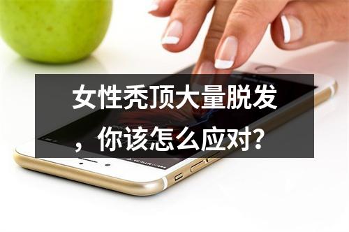 女性秃顶大量脱发，你该怎么应对？