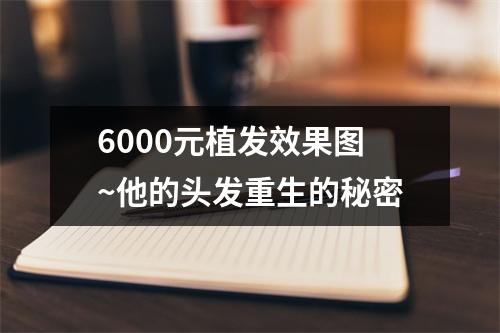 6000元植发效果图~他的头发重生的秘密