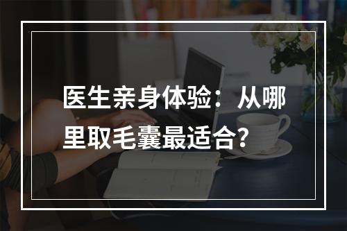 医生亲身体验：从哪里取毛囊最适合？