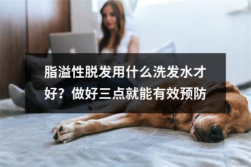 脂溢性脱发用什么洗发水才好？做好三点就能有效预防