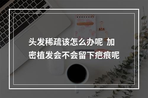 头发稀疏该怎么办呢  加密植发会不会留下疤痕呢