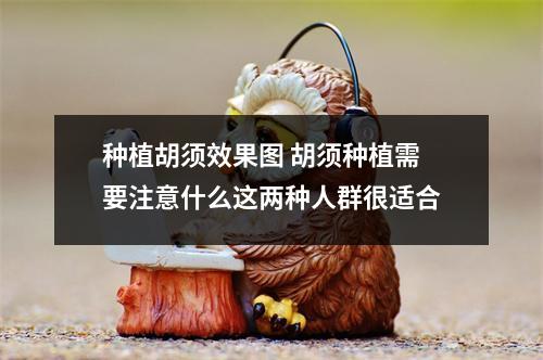 种植胡须效果图 胡须种植需要注意什么这两种人群很适合