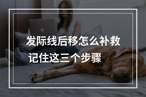 发际线后移怎么补救 记住这三个步骤