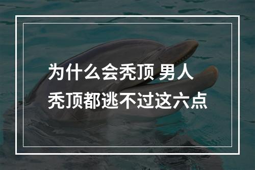 为什么会秃顶 男人秃顶都逃不过这六点