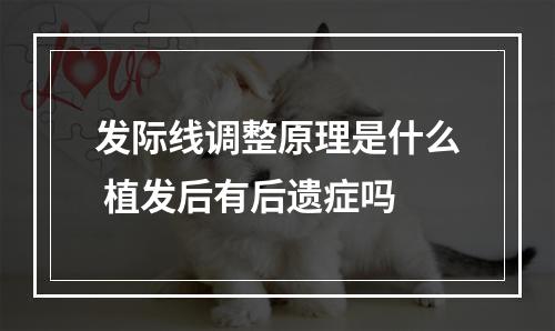 发际线调整原理是什么 植发后有后遗症吗