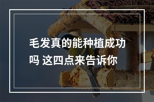 毛发真的能种植成功吗 这四点来告诉你