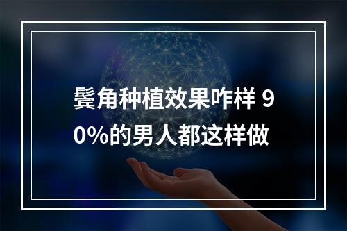 鬓角种植效果咋样 90%的男人都这样做