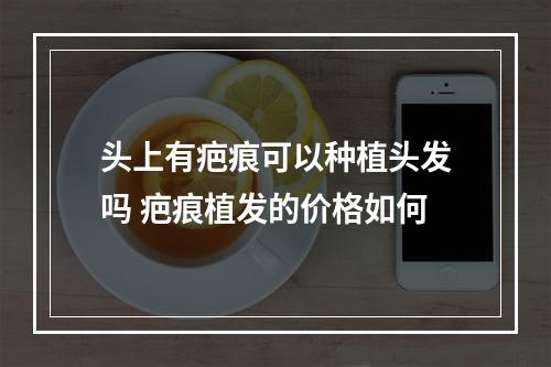 头上有疤痕可以种植头发吗 疤痕植发的价格如何