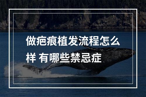 做疤痕植发流程怎么样 有哪些禁忌症