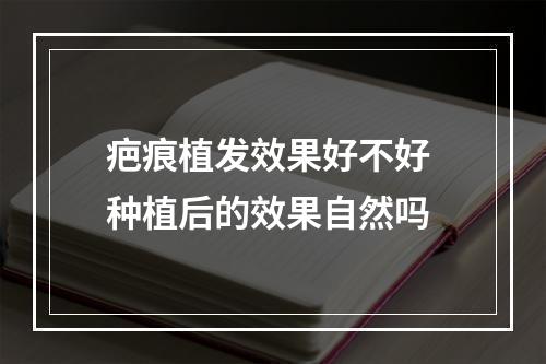 疤痕植发效果好不好 种植后的效果自然吗