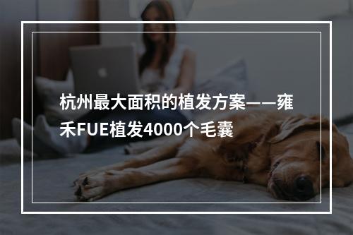 杭州最大面积的植发方案——雍禾FUE植发4000个毛囊