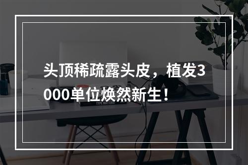 头顶稀疏露头皮，植发3000单位焕然新生！