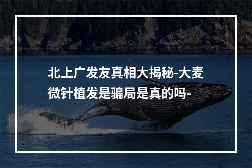 北上广发友真相大揭秘-大麦微针植发是骗局是真的吗-