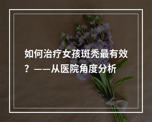 如何治疗女孩斑秃最有效？——从医院角度分析