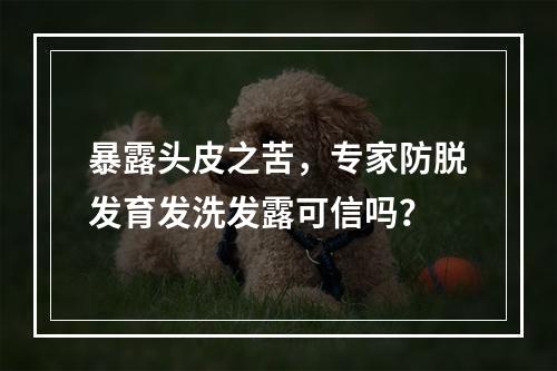 暴露头皮之苦，专家防脱发育发洗发露可信吗？