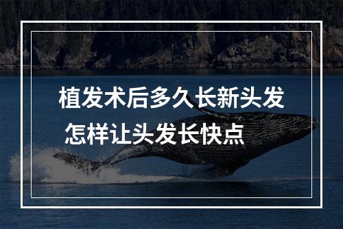 植发术后多久长新头发 怎样让头发长快点