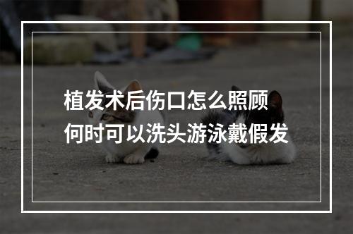 植发术后伤口怎么照顾 何时可以洗头游泳戴假发