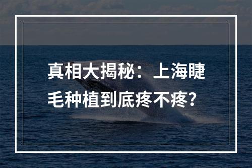 真相大揭秘：上海睫毛种植到底疼不疼？