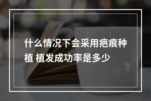 什么情况下会采用疤痕种植 植发成功率是多少